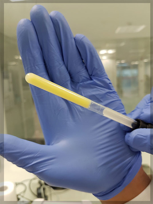 Fibroblast Kültürü Tedavisi