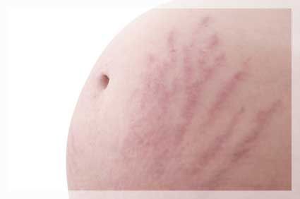 Gebelikte görülen deri hastalıkları