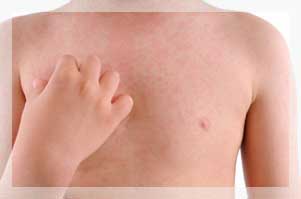 ÜRTİKER - KURDEŞEN